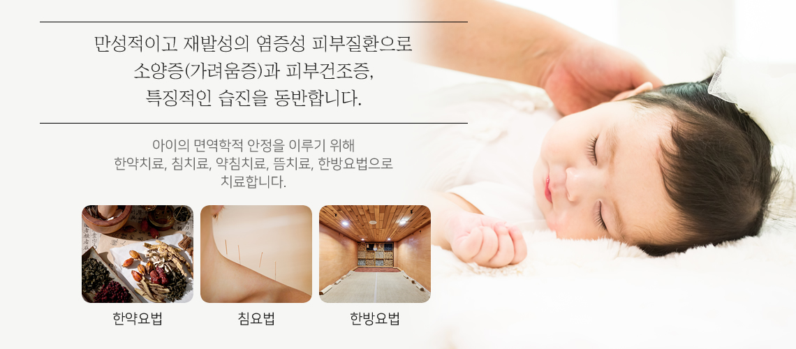 아토피 피부염의 원인과 치료목표