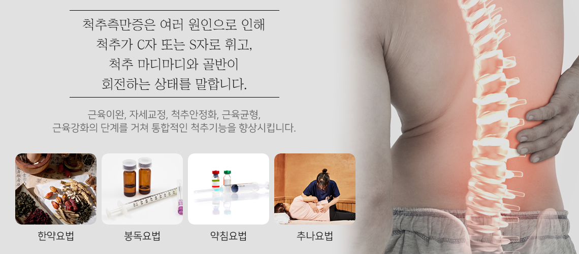 척추측만증의 원인과 치료목표