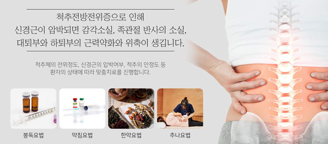 척추전방위증 원인과 치료목표