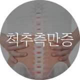 척추측만증